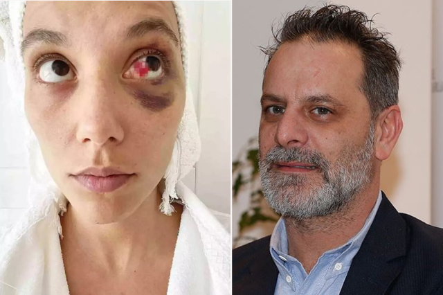 Ozan Güven'e 'kasten yaralama' suçundan hapis cezası